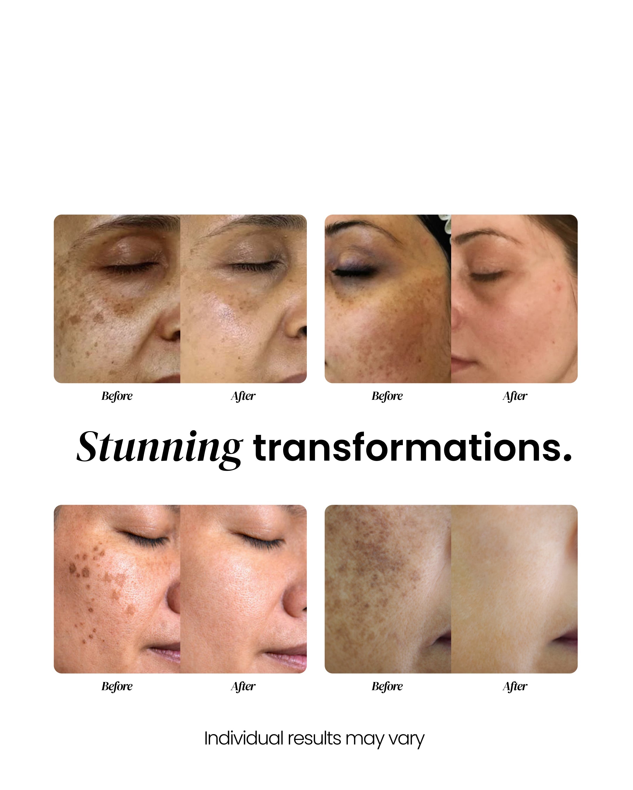 Dark Spot Corrector.