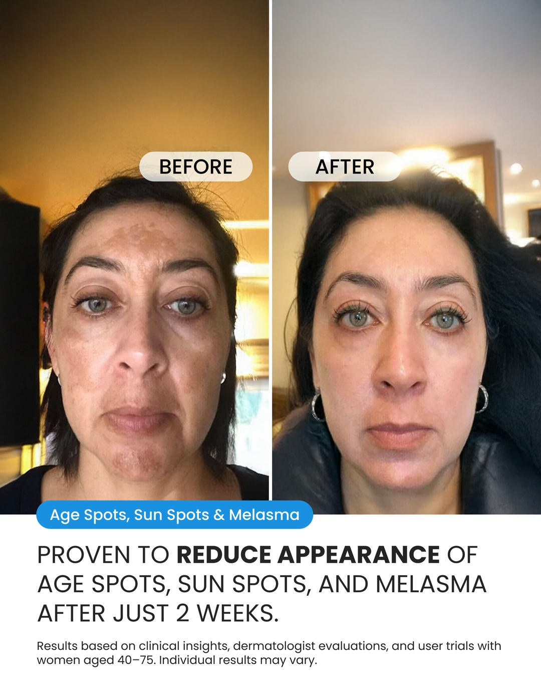 Dark Spot Corrector