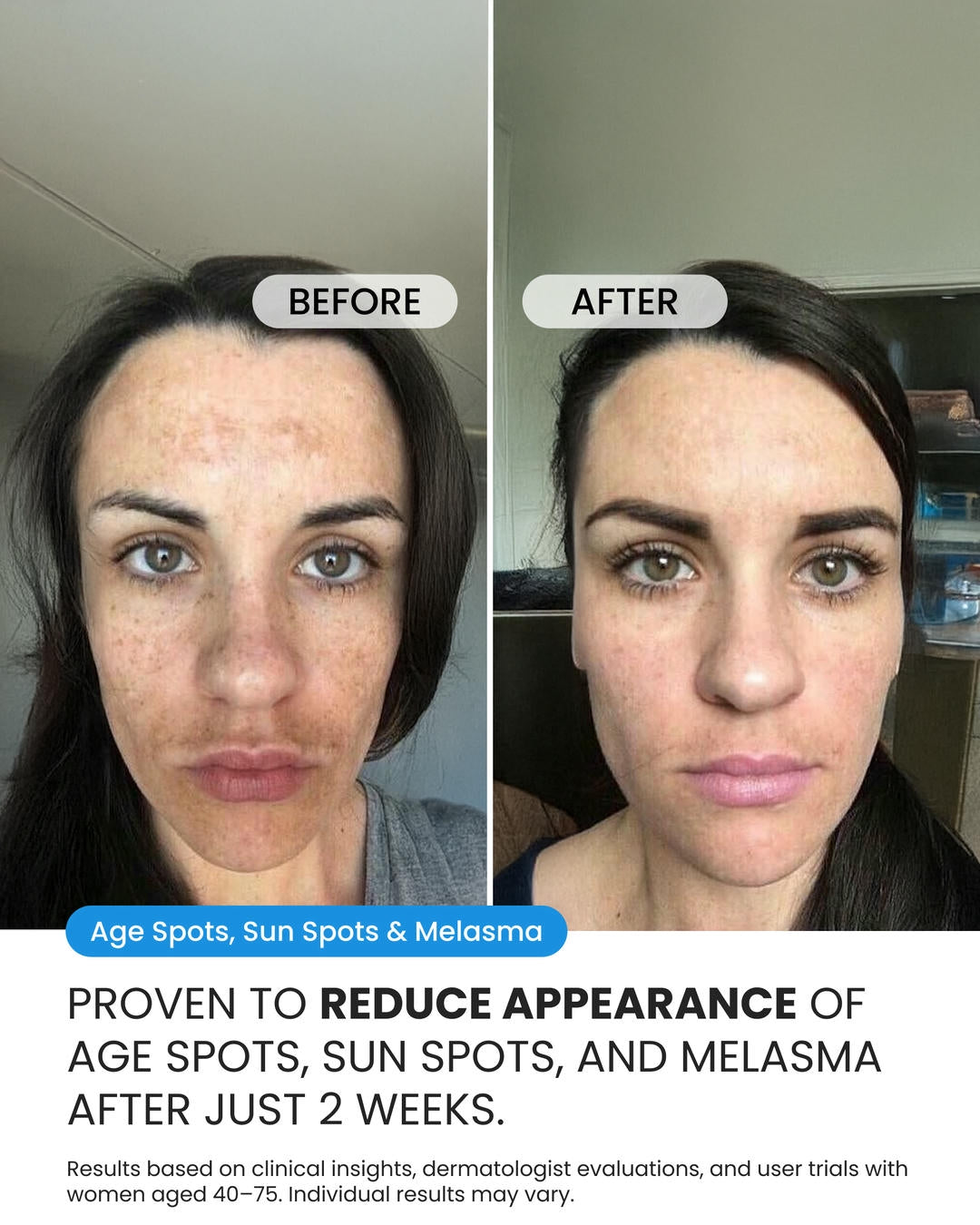 Dark Spot Corrector