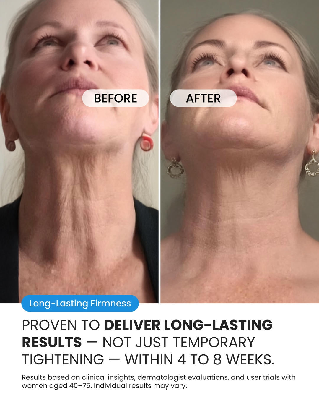 Neck Cream