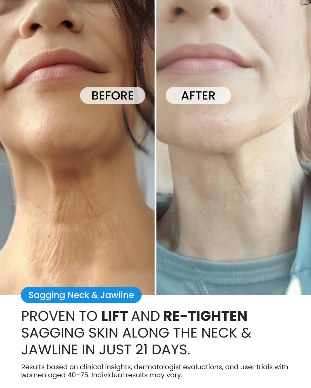 Neck Cream