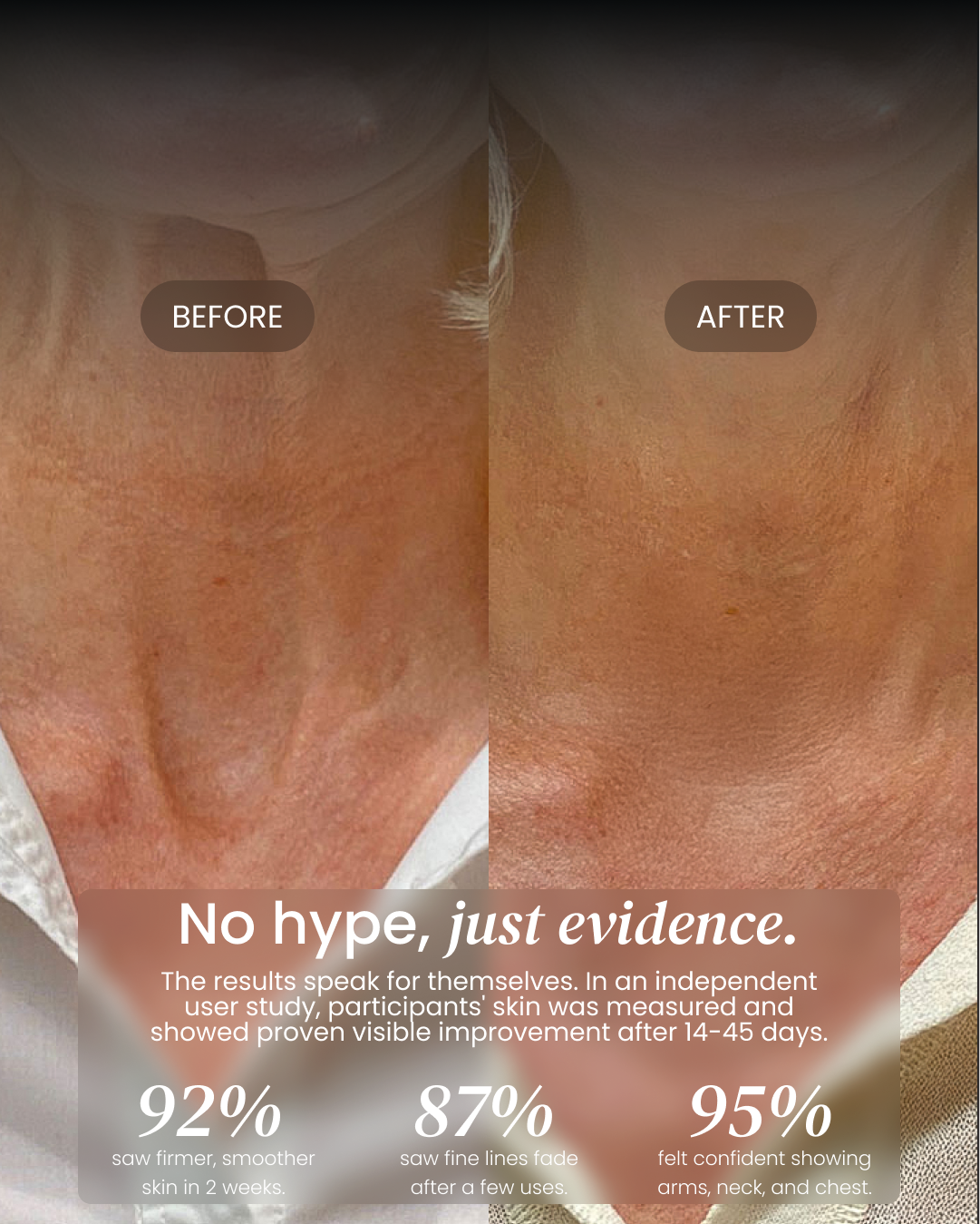 Neck Cream