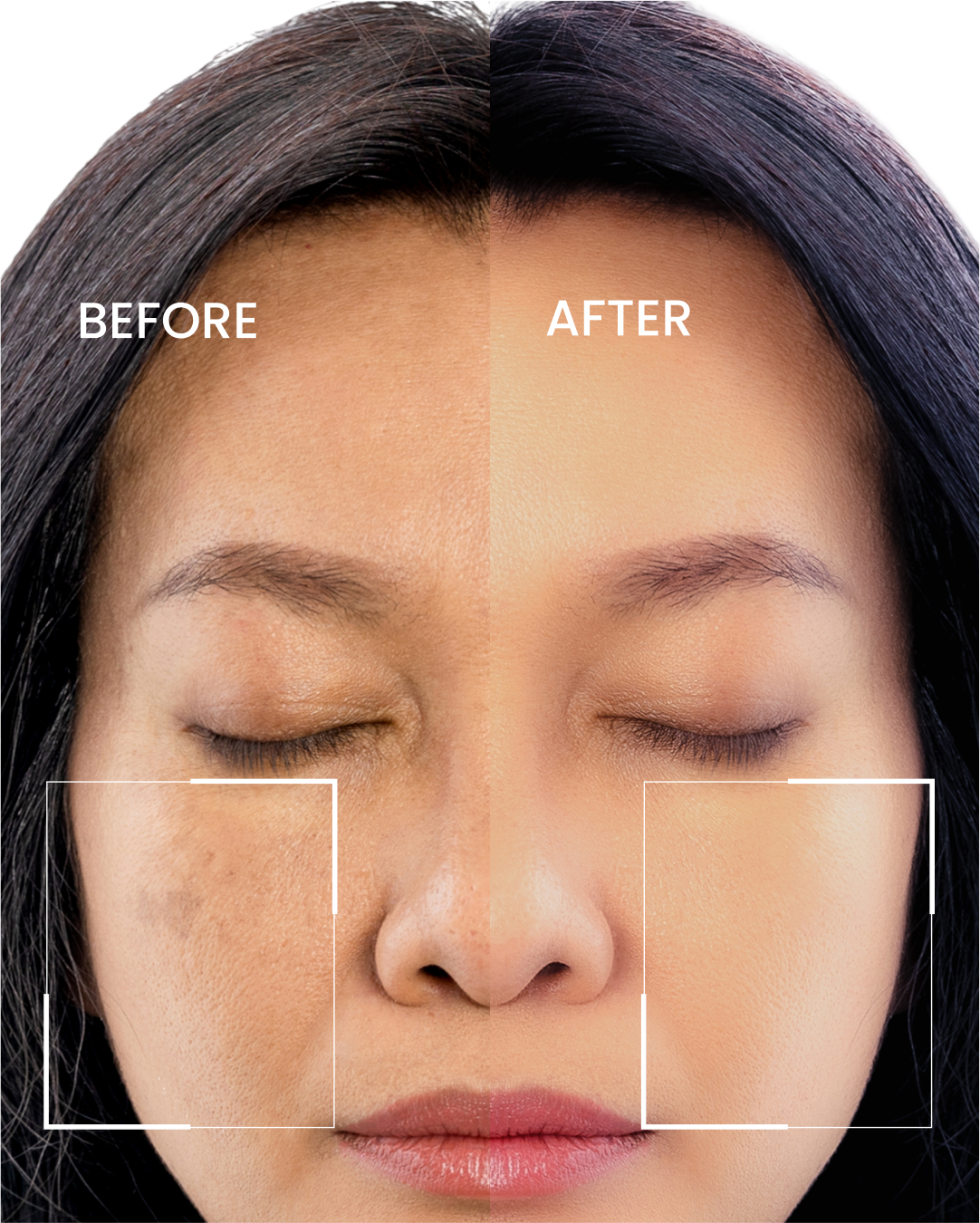 Dark Spot Corrector.