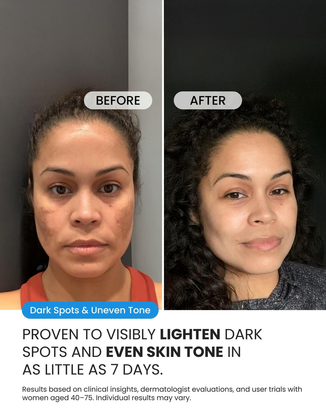 Dark Spot Corrector